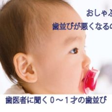 赤ちゃんのおしゃぶり 歯並びが悪くなる？！良くするには？　歯医者に聞く0～1才の歯並び【歯医者コラム総集編１】